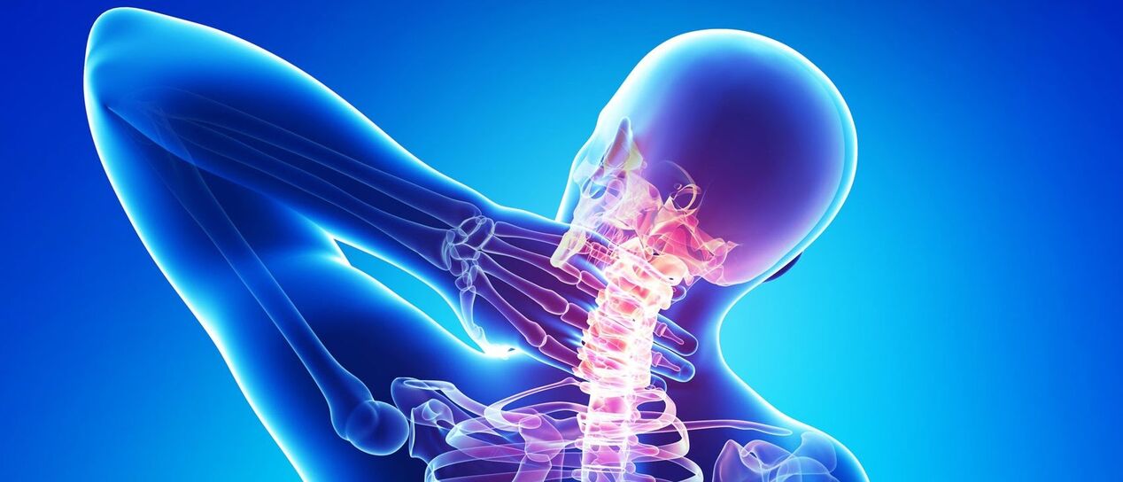 Cervical osteochondosis is a pathological process in the area of ​​the spine