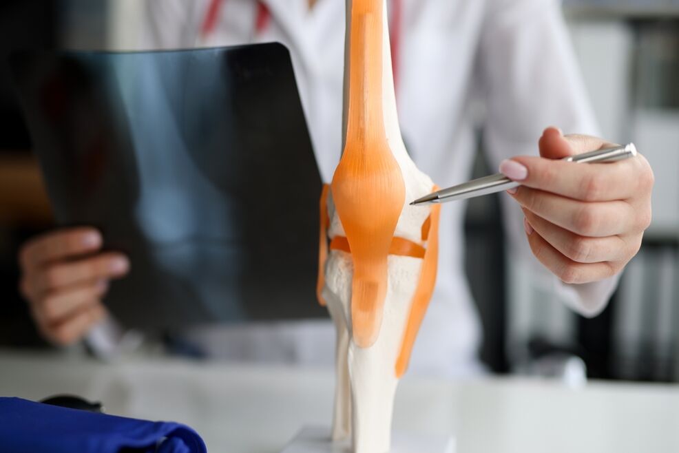 Demonstration of a joint in which degenerative changes lead to the development of osteoarthritis